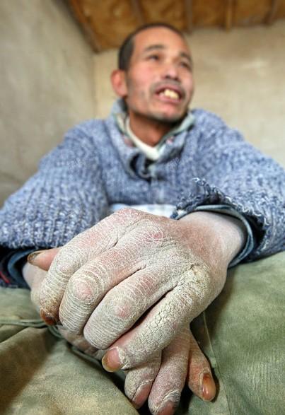 罕见新闻:"包身工"遭多年非人奴役! [复制]