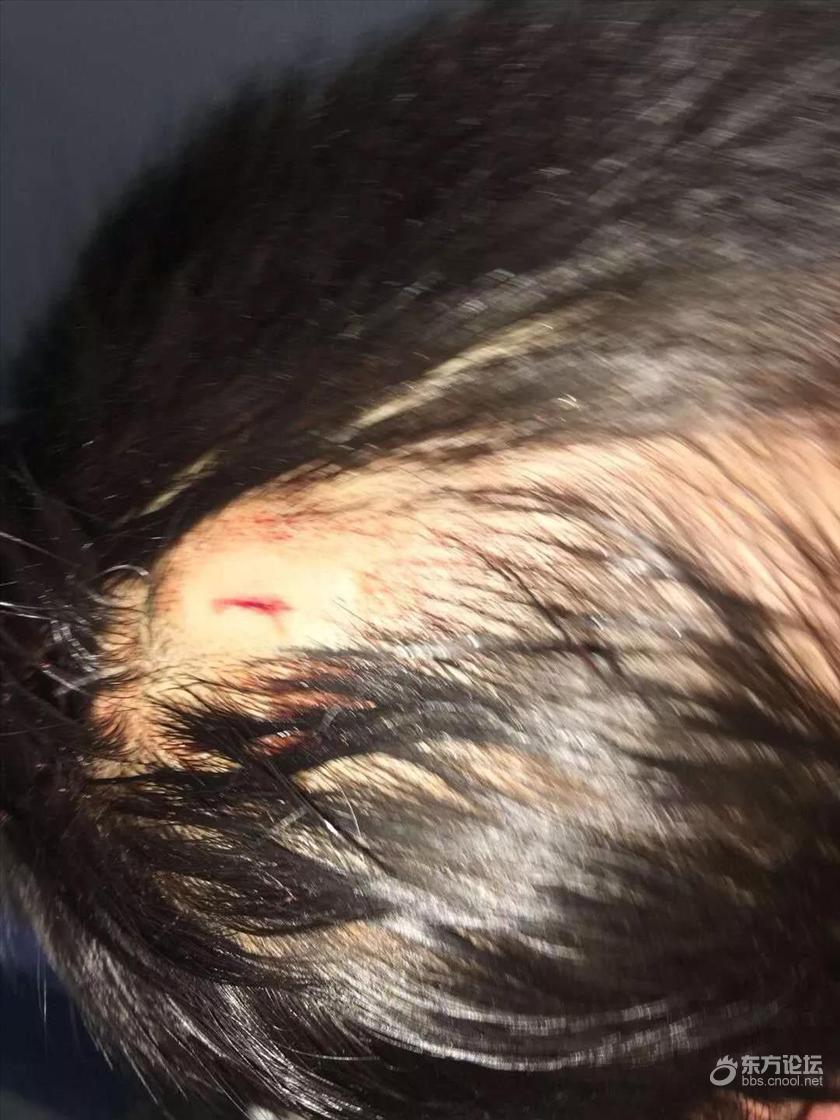 宁波2岁男孩在环球银泰城被割破头皮,血流一地!商场回应...