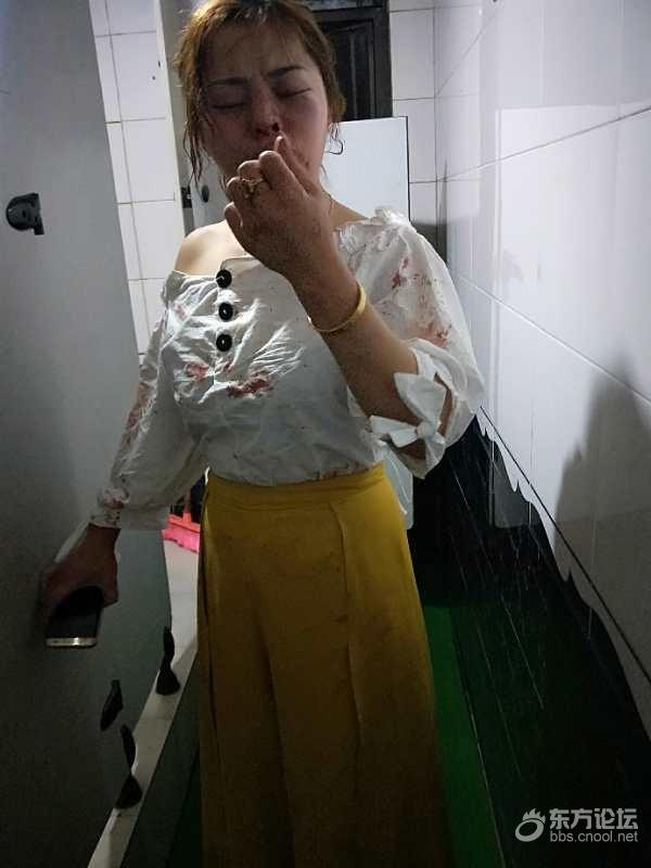 因拒绝公司情趣游戏安排,遭到严重殴打,谁还我公道?