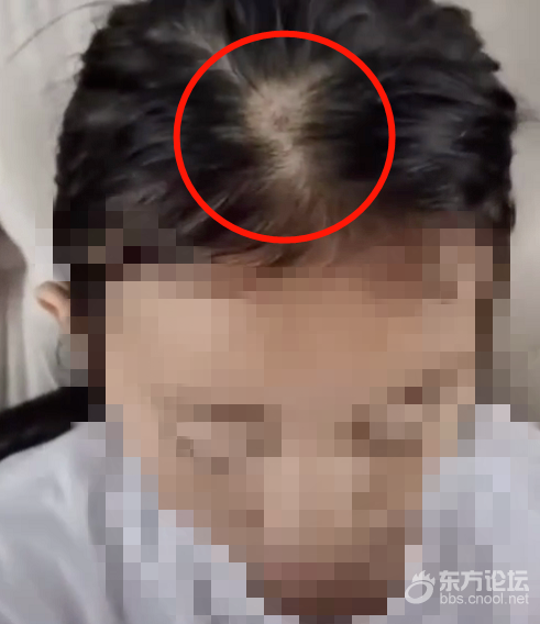 带回家才几天,女儿头顶
