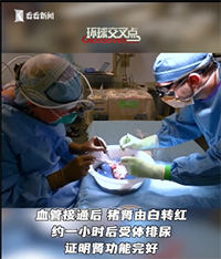 美一医院成功完成猪肾脏移植人体手术